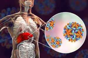 Initiative de santé mondiale: sensibilisation à l'hépatite C