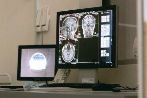 Understanding Electric Brain Stimulation