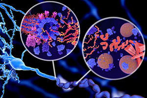 Biointerface Engineering: Protein Aggregation and Biomaterials