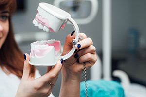 Introduction à la biomécanique orthodontique