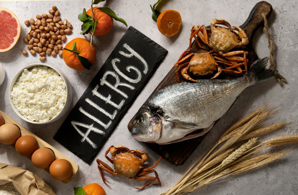 Alison Launches Free Online Course on Food Allergy Awareness Essentials